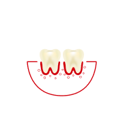 ¿Con qué frecuencia usa hilo dental o se limpia los espacios entre los dientes?