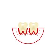 ¿Con qué frecuencia usa hilo dental o se limpia los espacios entre los dientes?