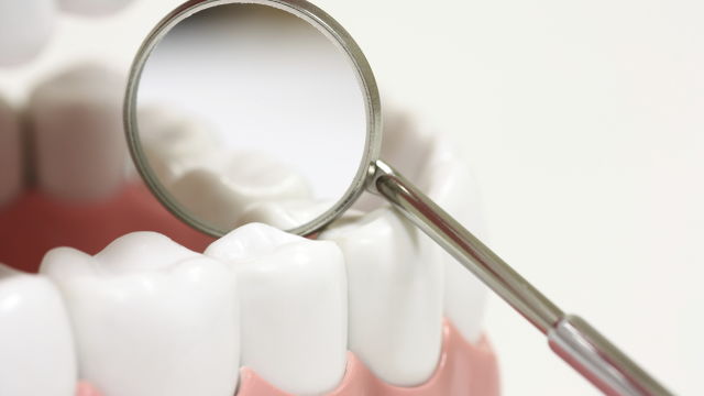 Primer plano de una dentadura siendo revisada