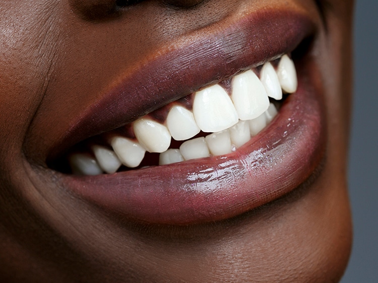 close up of woman smiling with white teeth