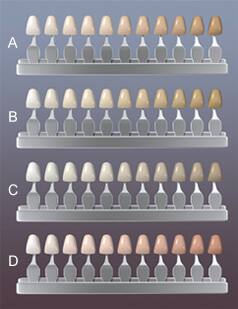 Cómo Determino el Color Específico de Mis Dientes